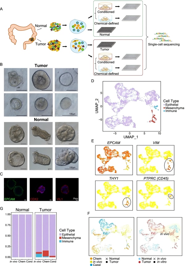 P7 | organoid-source-tissue-single-cell-case.jpg | Wang and colleagues Figure 1 showing study design, single-cell profiles, markers and cell-type proportions.